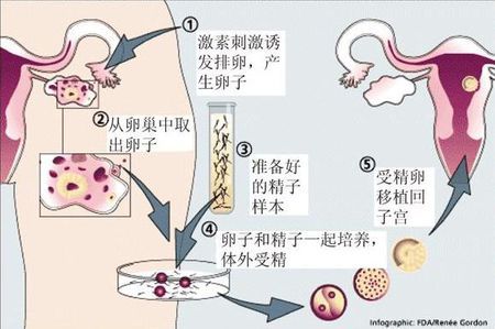 严重少弱精